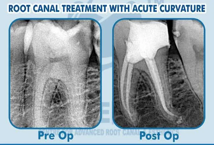 Treatments with Advanced Technology at C.A.R.E Dental Clinic